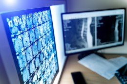 MEIOS DE CONTRASTE EM RADIODIAGNÓSTICO